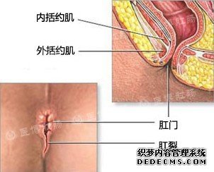 大便一颗一颗的很硬拉不出来怎么办